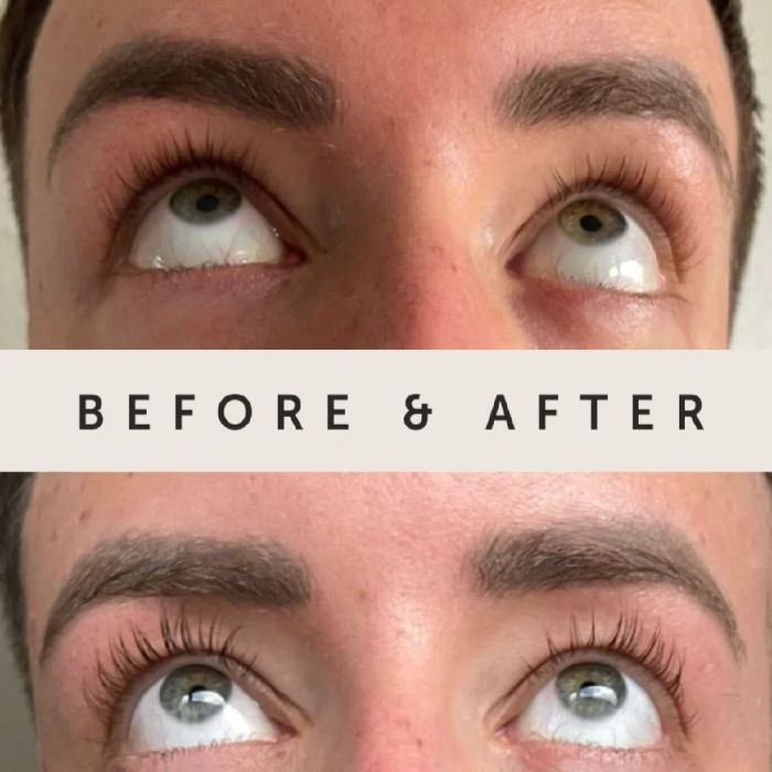 Natucain Lash Serum
