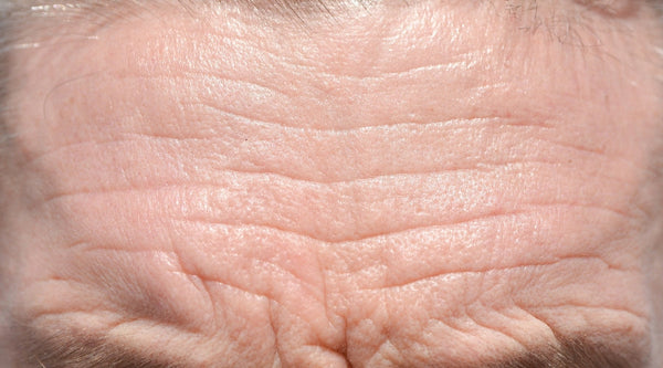 Wrinkles in men: what you can do!