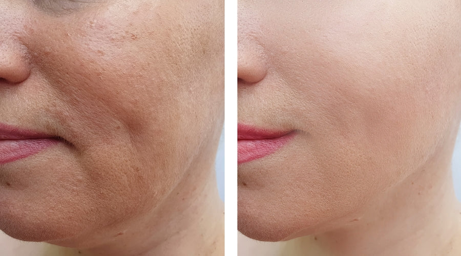 10 tips tegen rimpels gezicht: werken ze echt?