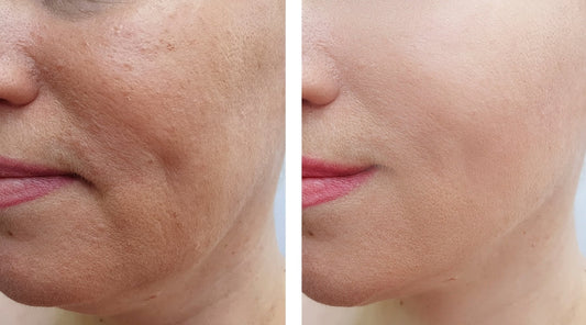 10 tips tegen rimpels gezicht: werken ze echt?