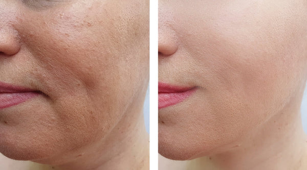 10 tips tegen rimpels gezicht: werken ze echt?