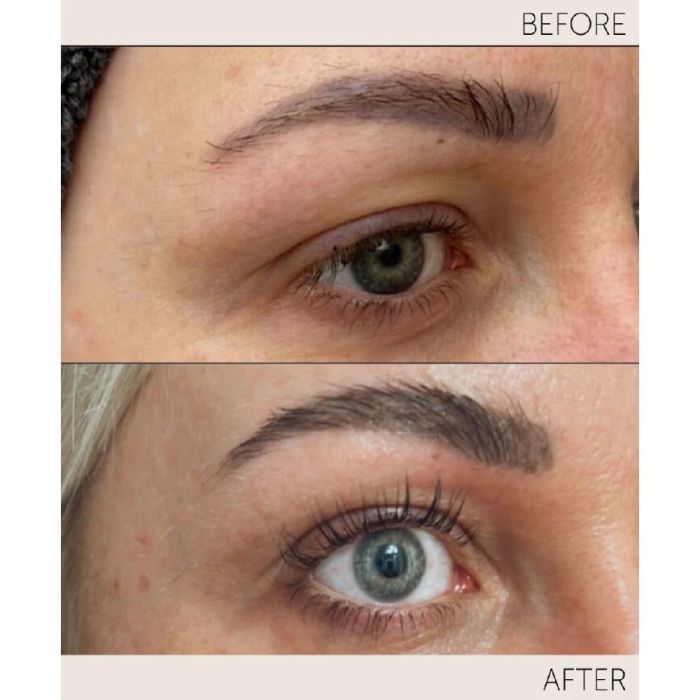Natucain Lash Serum